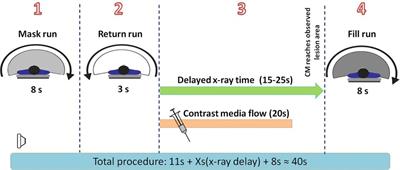 Angiosome-directed endovascular intervention and infrapopliteal disease: Intraoperative evaluation of distal hemodynamic changes and foot blood volume of lower extremity